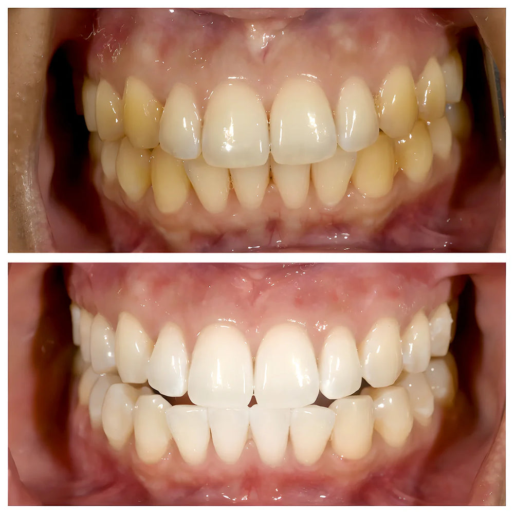 Dentifricio WhiteWave